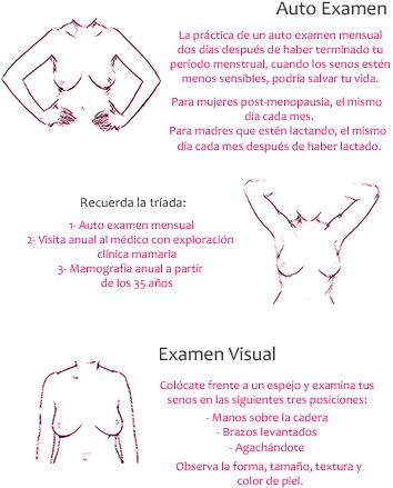 Remedios de homeopatía para los nódulos en los senos Remedios de homeopatía para los nódulos en los senos